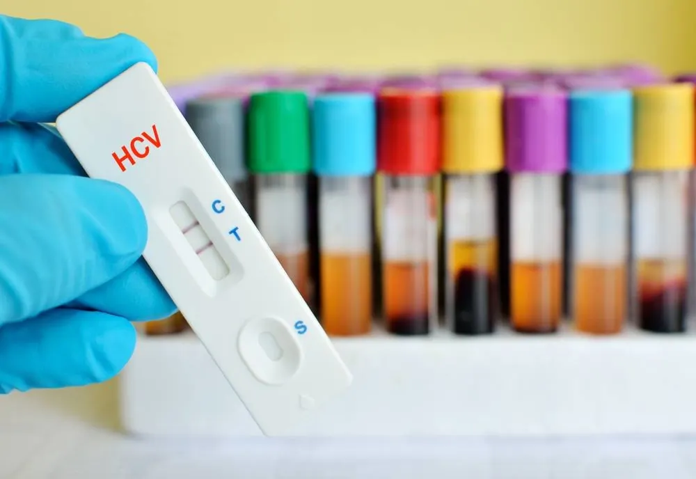 Testare pentru hepatita B și C la Penitenciarul Gherla