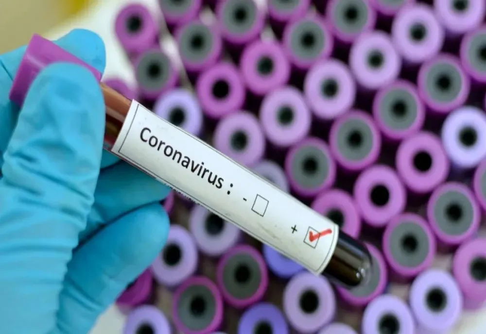Ultimă oră: A explodat numărul de cazuri COVID. 460 de bolnavi în 24 de ore