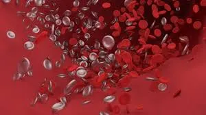 tromboza_venoasa