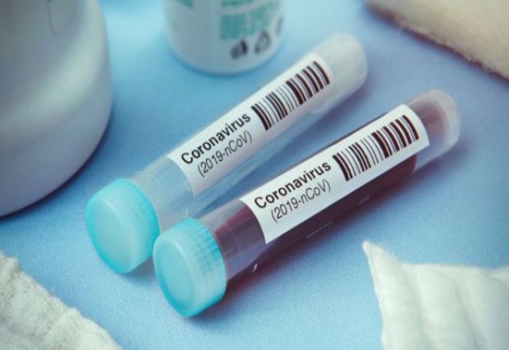 Două persoane au decedat de coronavirus în România. 433 de persoane infectate