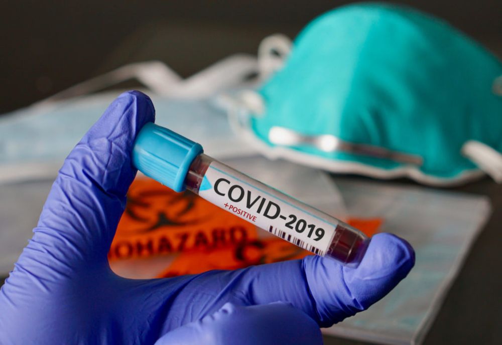 CoVid-19: 1.104 infectați, 19 decedați,151 vindecați
