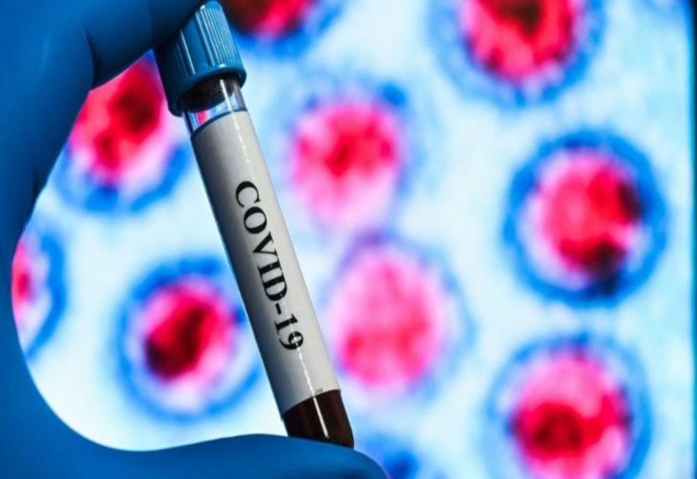 Bilanț CoVid-19: 1.189 infectați, 556 vindecați, 37 decedați! În ATI sunt internați 504 pacienți