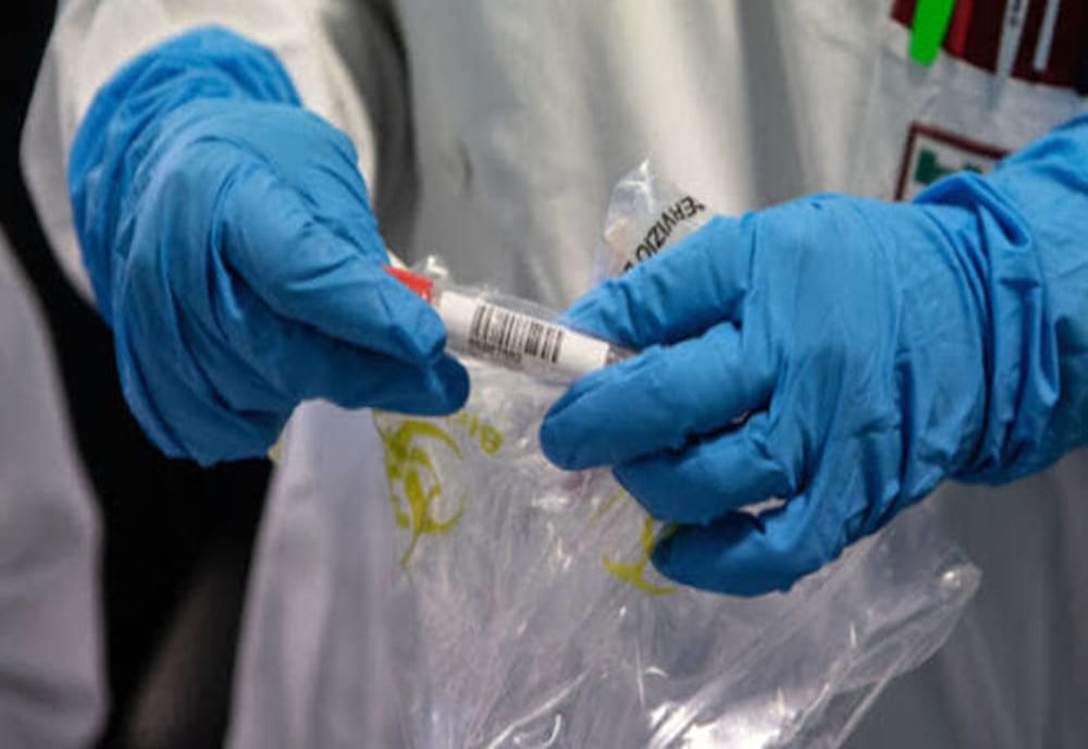 Bilanț coronavirus 2 septembrie: 1.470 de cazuri noi, 26 decese
