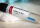 Bilanț coronavirus 13 iulie: 51 de cazuri noi și 4 decese