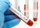 Bilanț coronavirus 17 octombrie: 11.546 cazuri noi și 299 decese