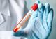 Bilanț coronavirus 22 decembrie: 851 cazuri noi și 62 decese dintre care 18 anterioare